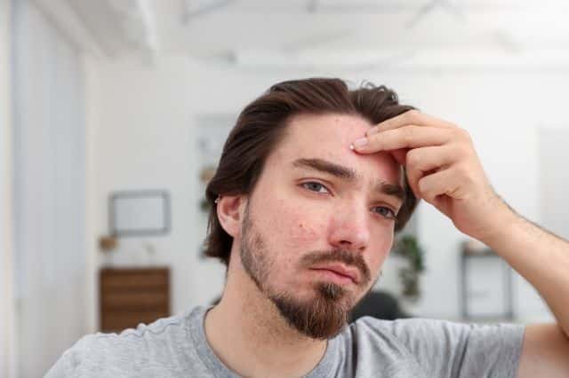 wirkung der sägepalme Sägepalme Wirkung mann